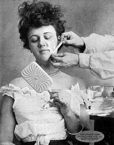 1905 Plaster treatment for wrinkles.