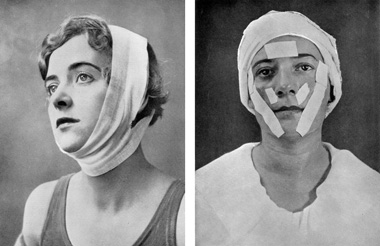 1946 Maria Verni treatment