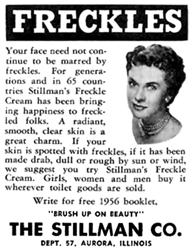 1956 Stillman freckle remover