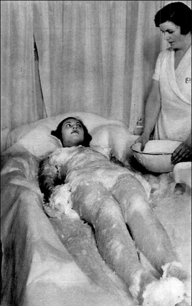 1937 Phyllis Earle Wax Treatment