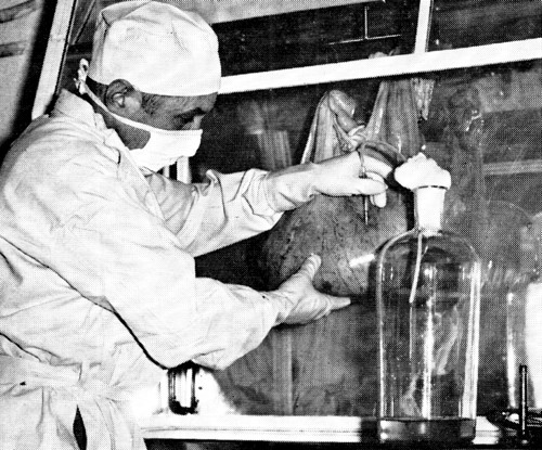 1967 extracting amniotic fluid