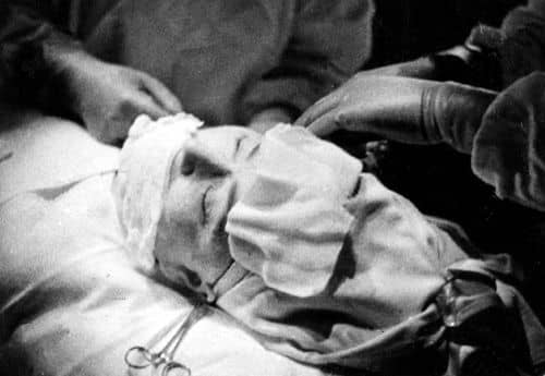 1940 Edna Wallace Hopper undergoing facial surgery
