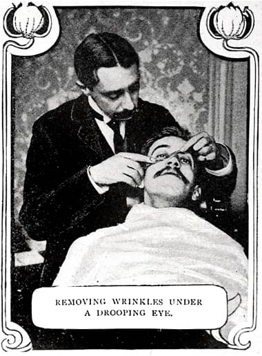 1902 Removing wrinkles under the eyes