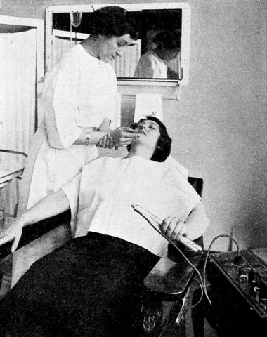 1914 Removing a mole using indirect fulguration