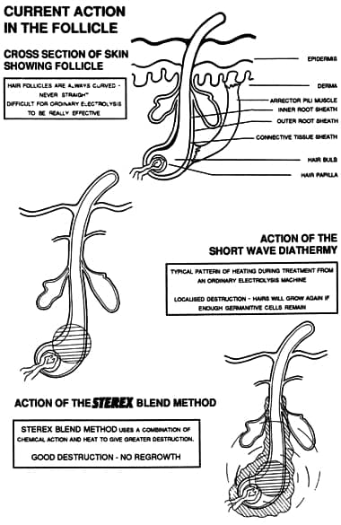 Sterex brochure