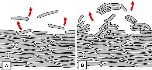 Normal and abnormal cormeocytes