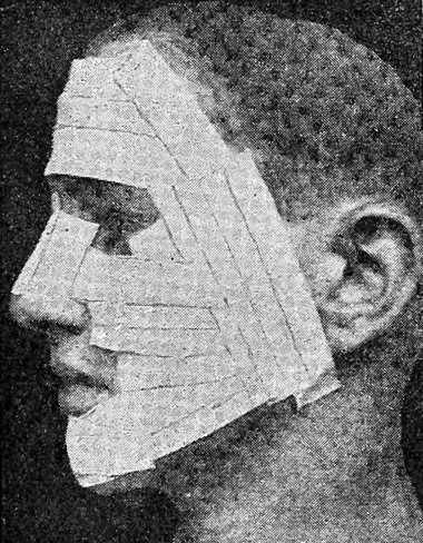 1916-bandage