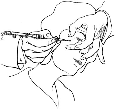 Drill