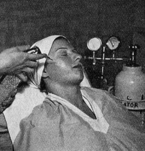 1935-oxylation