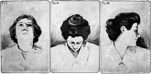 1899 Ayer neck exercises